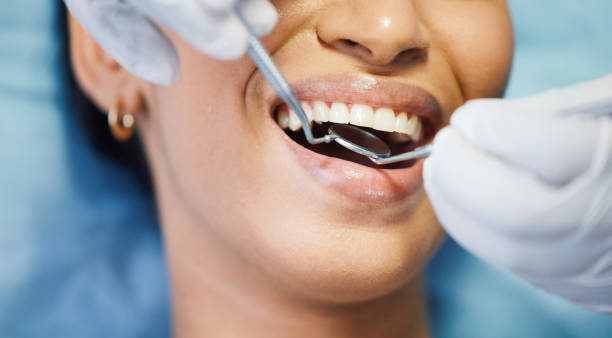 Best Broken Tooth Emergency  in Beechwood Trails, OH
