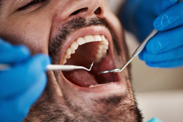 Best Cracked Tooth Emergency Dentist  in Beechwood Trails, OH