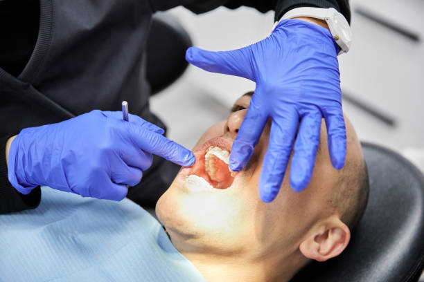 Best Dentist for Tooth Abscess  in Beechwood Trails, OH